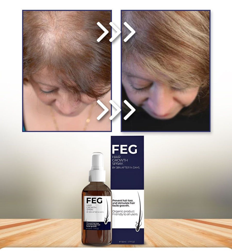 بخاخ إنبات الشعر بلس — نتائج خلال 14 يومًا  Hair Growth Spray PLUS — Results in 14 Days