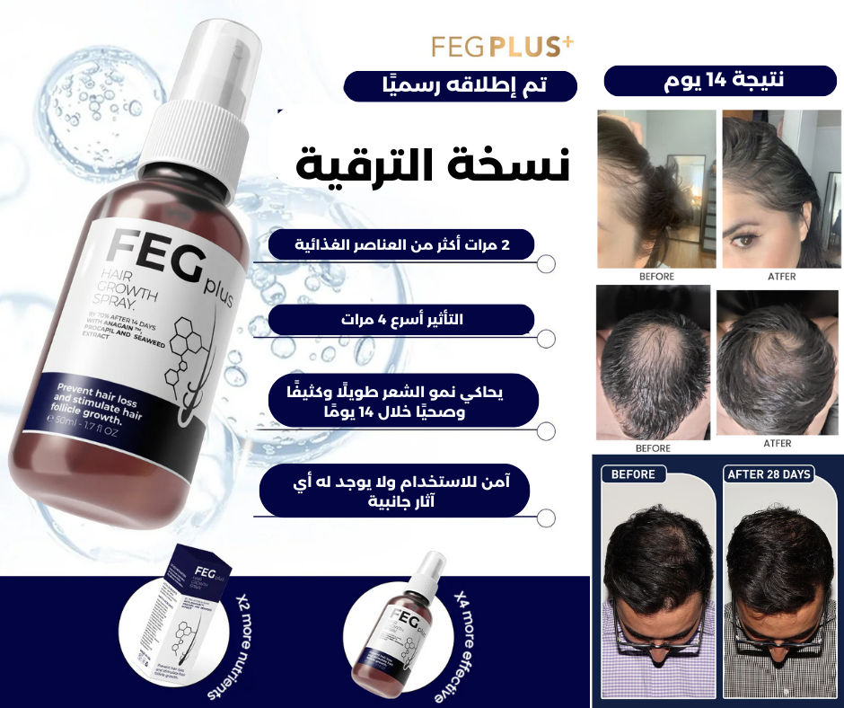 بخاخ إنبات الشعر بلس — نتائج خلال 14 يومًا  Hair Growth Spray PLUS — Results in 14 Days