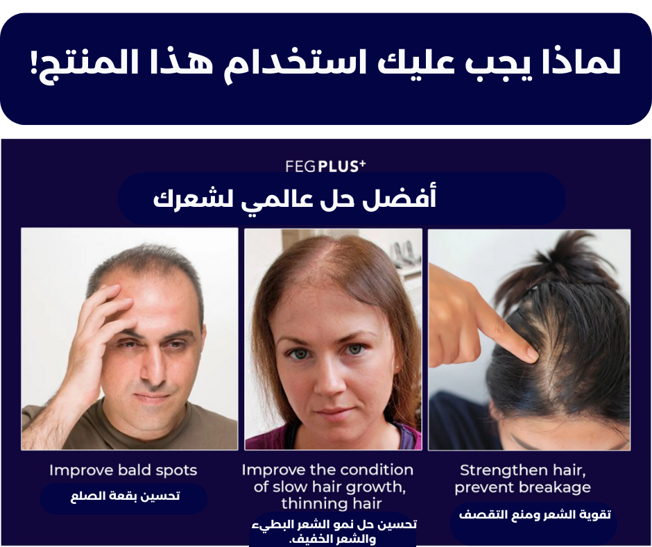 بخاخ إنبات الشعر بلس — نتائج خلال 14 يومًا  Hair Growth Spray PLUS — Results in 14 Days